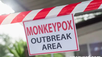 Monkeypox