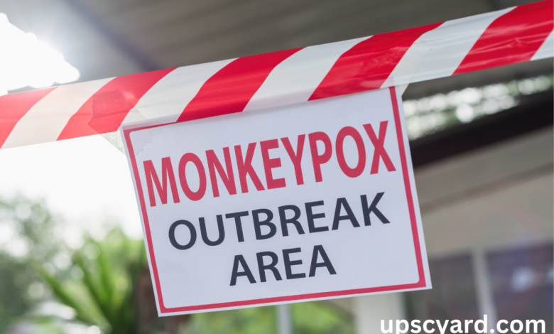 Monkeypox